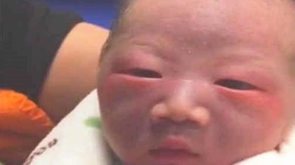 艰难顺产生下“丑娃娃”，宝妈看到好无奈，百天后：还好没扔掉(图2)